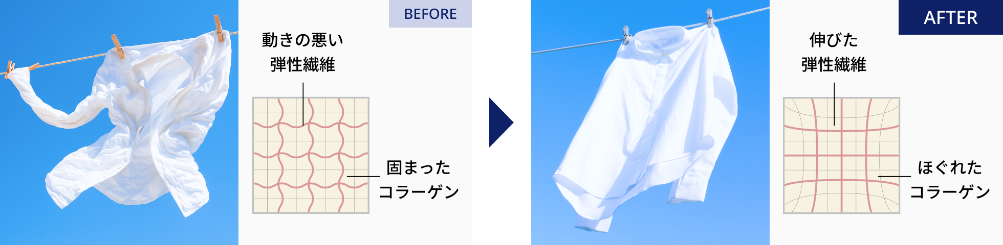 筋膜の形状記憶機能で、根本改善へ