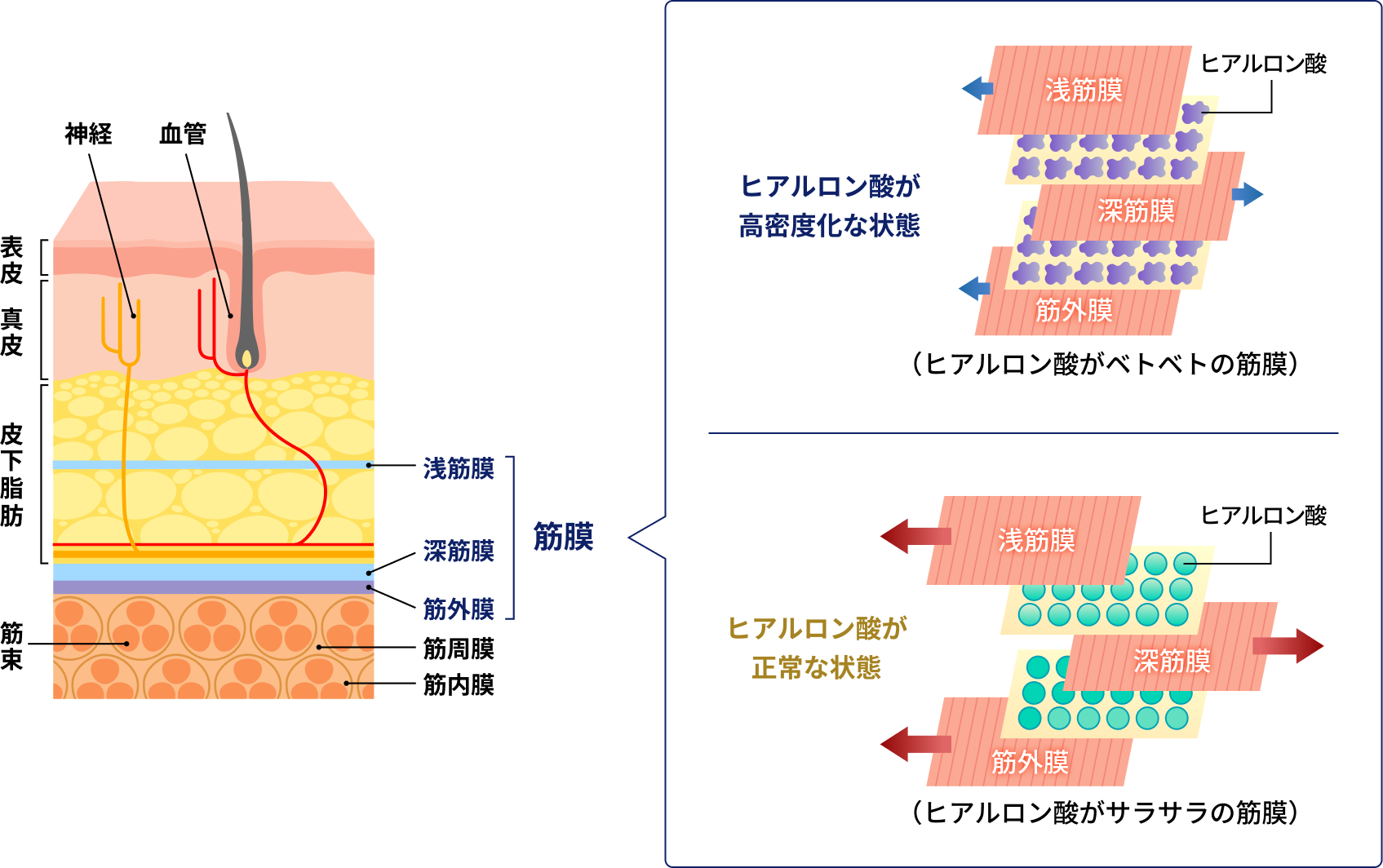 筋膜の高密度化の図解