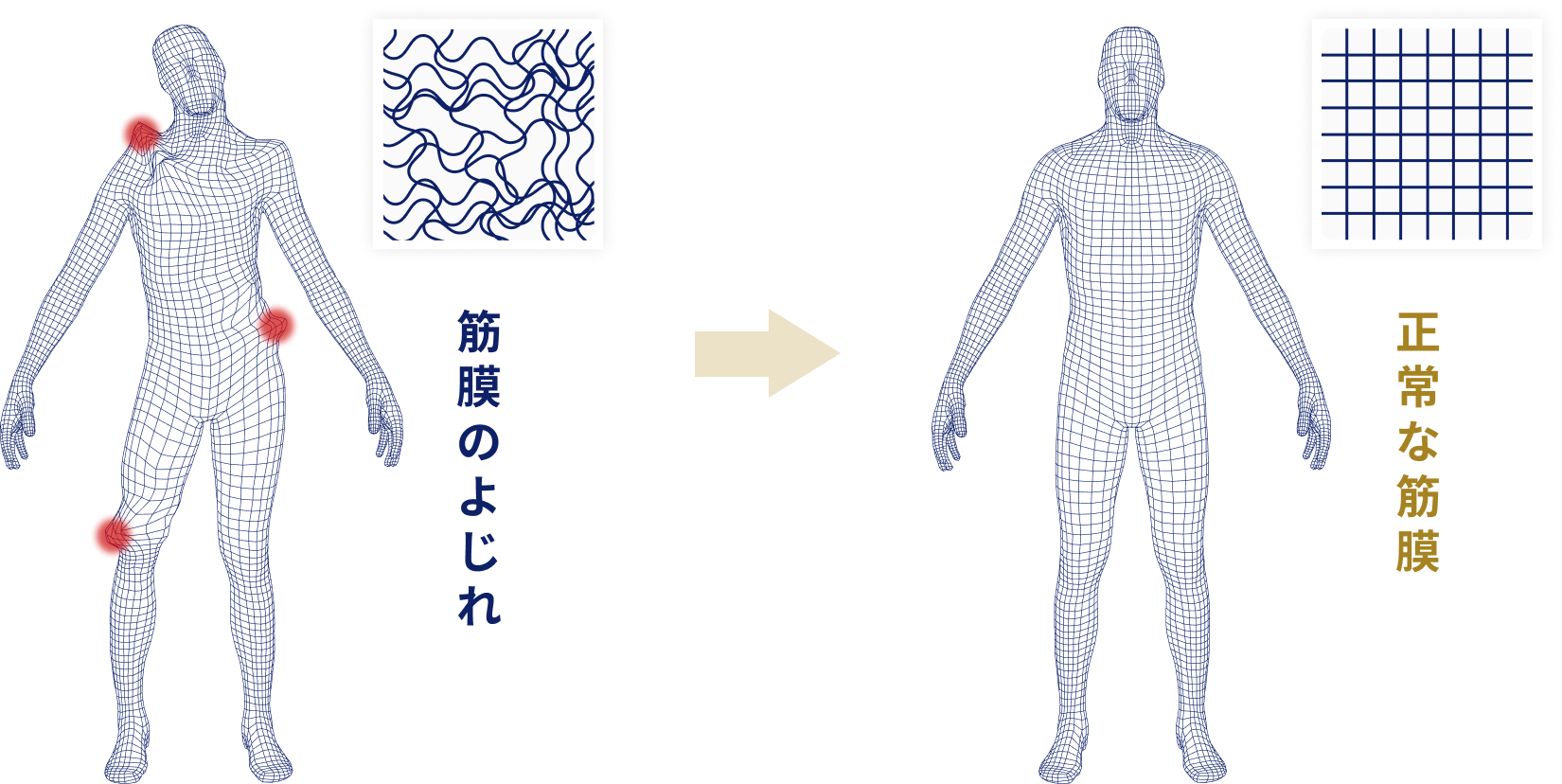 筋膜の形状記憶性の図解