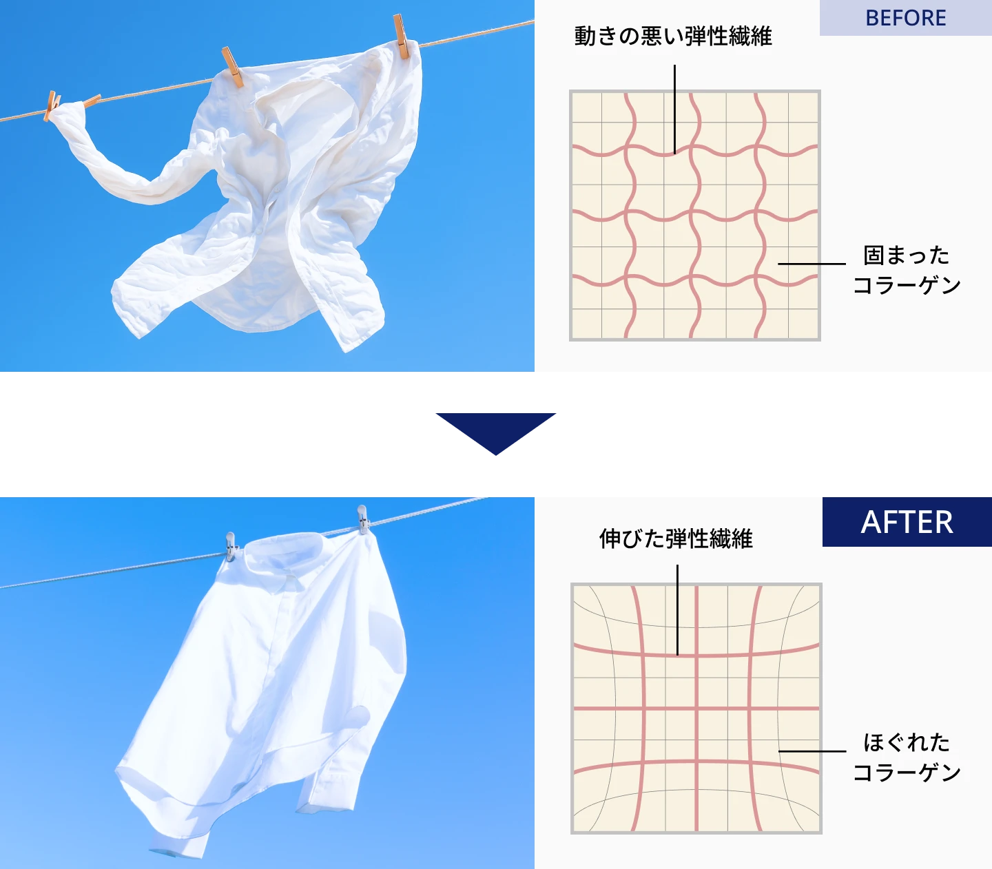 筋膜の形状記憶機能で、根本改善へ