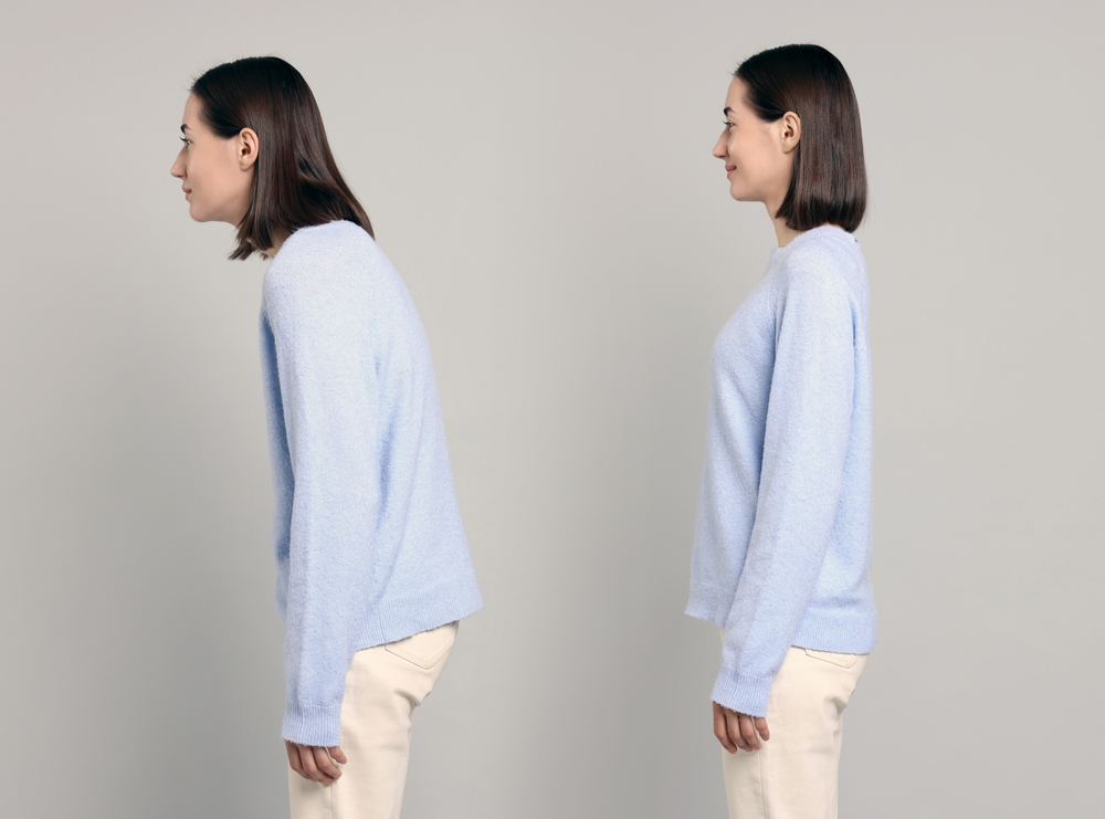 猫背で考えられるデメリット