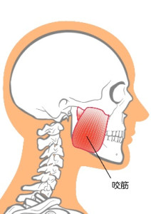 咬筋の位置を示す画像
